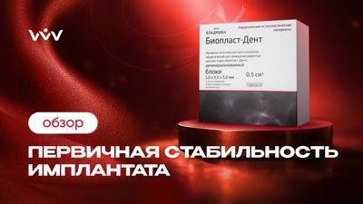 Биопласт-Дент блоки — Первичная стабильность имплантата | Обзор.